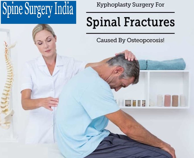 Kyphoplasty Surgery India