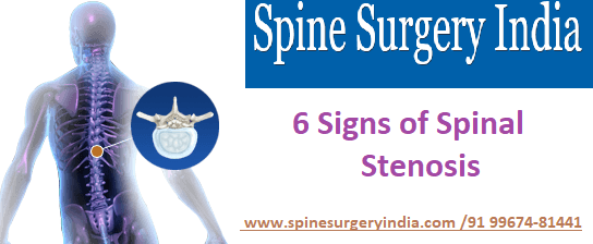 Spinal stenosis in india