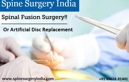 Artificial Disc Replacement or Spinal Fusion