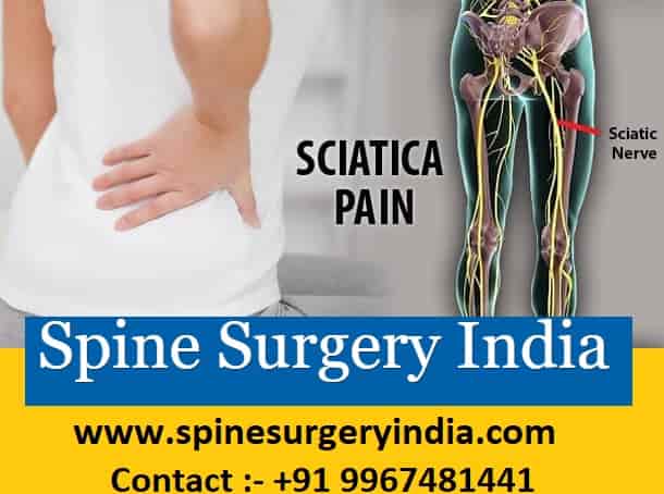 Sciatica Treatment india