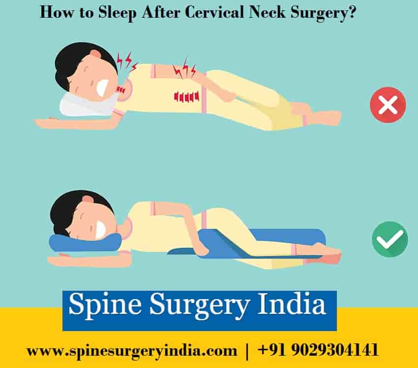 cervical neck surgery