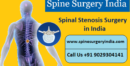 Spinal Stenosis Surgery in India
