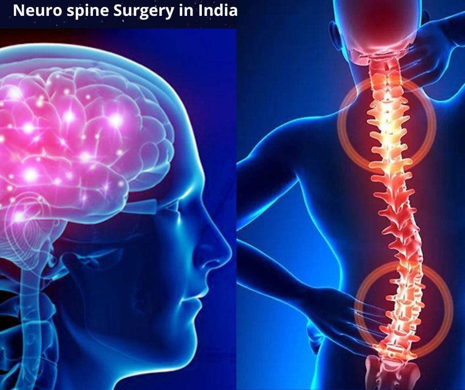 Neuro spine Surgery in India