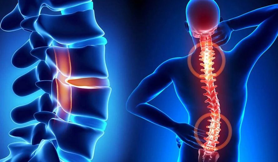 neuro spine surgery in India
