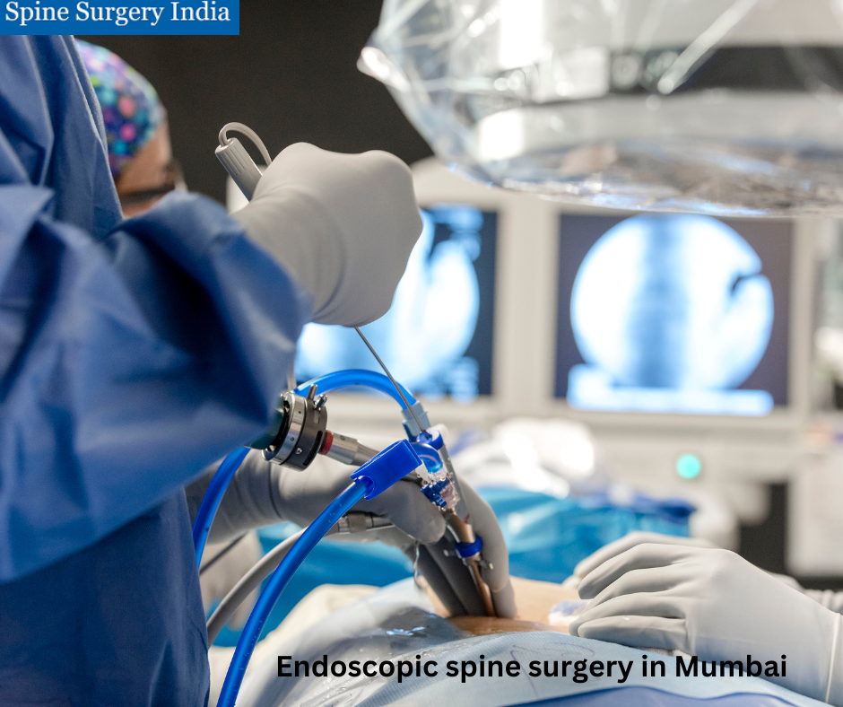 Endoscopic spine surgery in Mumbai
