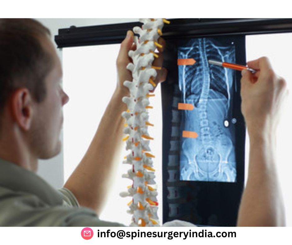 best spine doctor in delhi